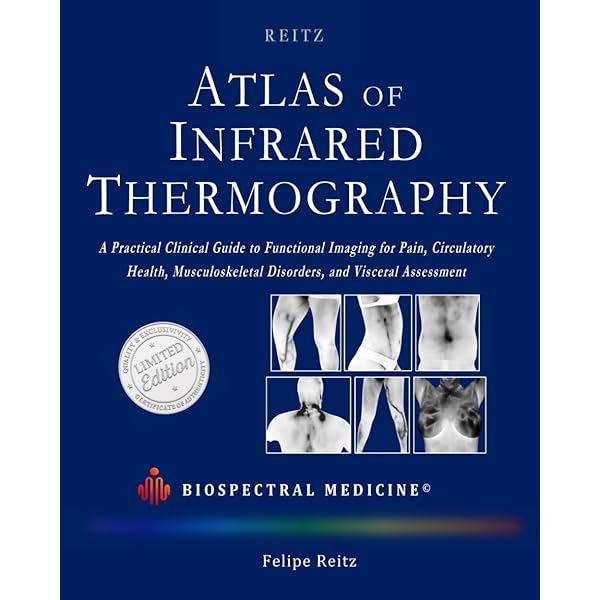 Atlas of Cardiovascular Computed Tomography: 9781573402675 Atlas of Cardiovascular Computed Tomography: 9781573402675